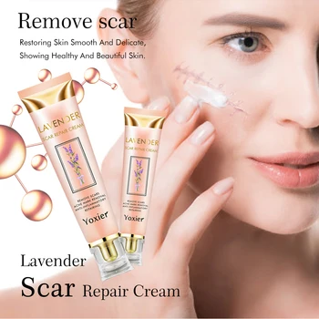 Scar Removal Cream Strij, Krema Akne Znamk Zdravljenje Opeklin Krema za Gladko in Mehča Kožo Krema za Vse Kože Hitra Dostava Slike 2